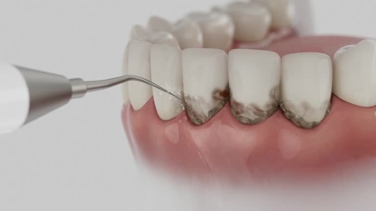 Reliable Emergency Dentist contractor in Bainbridge, OH by Smile Center Dentistry